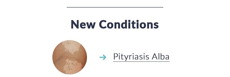 Get Treated for Pityriasis Alba 