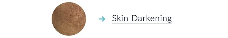 Get Treated for Skin Darkening 