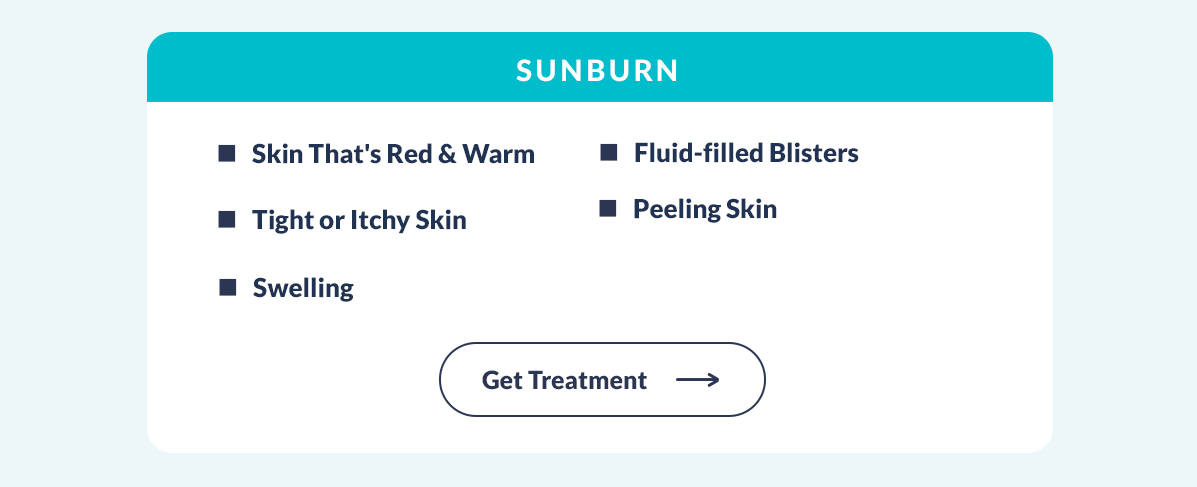 Get Sunburn Treatment